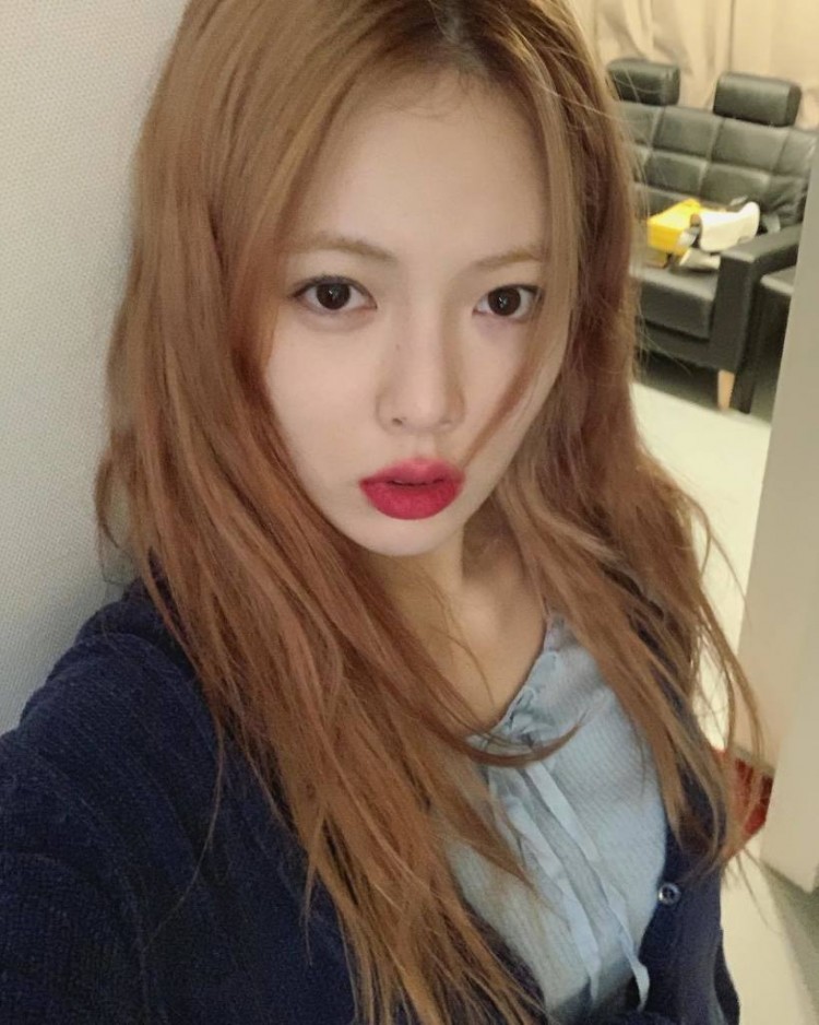 HyunA đăng ảnh đầu gối thâm tím netizen cảnh cáo đừng có dắt mũi công chúng rồi đóng vai nạn nhân - image 1