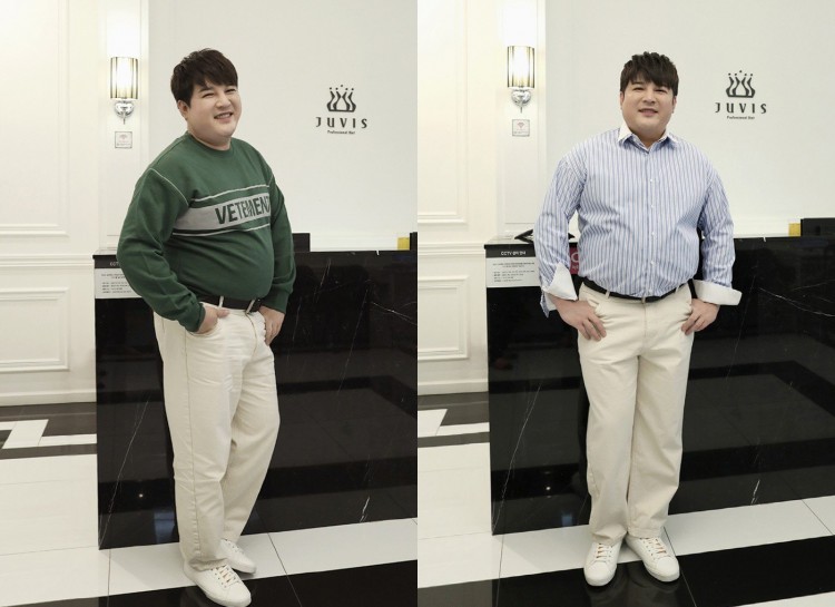 Shindong Super Junior bệnh tật ập tới vì cân nặng quá mức 116 kg tìm cách điều trị vì nguy hiểm  - image 1