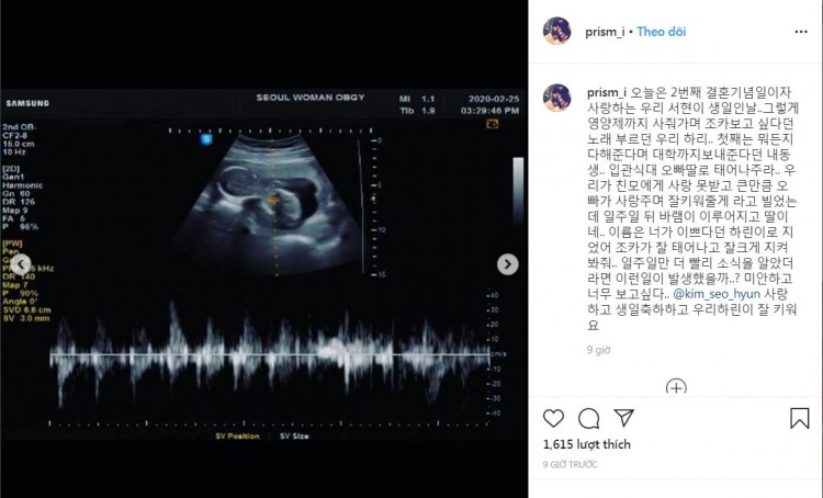 Anh trai Goo Hara Anh hy vọng em sẽ được tái sinh trở thành con gái của anh - image 3